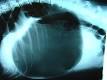 Bloat - Wikipedia, the free encyclopedia