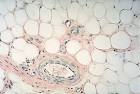 Adipose Tissue Color Images