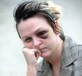 Criminal Compensation Injuries Continued