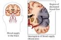 Your Health -