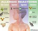 Anaphylaxis Symptoms