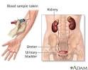 <b>Creatinine</b> is a metabolic end