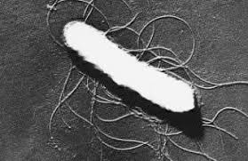 Two Babies Die in Hospital for E.coli batter 