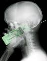 CELL PHONE RADIATION DANGER: introduced by Mark Goldfarb@Arts ...