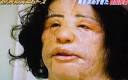 10 Worst Celebrity Plastic Surgeries Latest Hollywood Celebrity