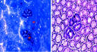 Modern Pathology - FIGURE 1 for article: Carcinogenesis in the GI ...