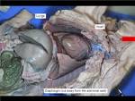 Fetal Pig Dissection