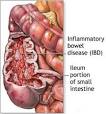 Gastrointestinal Disease - Dr. Ruiz