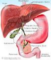 <b>Gallstones</b> Pain, Diet, Symptoms, Causes, Treatment - eMedicineHealth.