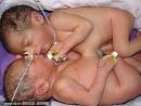 Tiny Kunal and Kartik were
