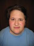 File:<b>Langer</b>-<b>Giedion syndrome</b>.