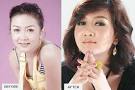 Wine Su Khine Thein (Before and After) Wine Su Khine Thein and cosmetic ... - wine-su-khine-thein-nose