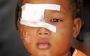 Haiti earthquake: injured