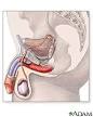 Penis Disorders: MedlinePlus