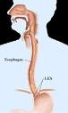 Virginia Surgery Associates, P.C. - General Surgical Information ...