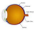 Collie Eye Anomaly (