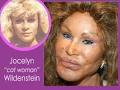 Will women of the future have lips so big they smother small children ... - jocelyn-wildenstein-ba