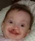 Cleft Advocate - Photo Gallery - Meet The Family! - KaileyRoseA