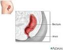 Rectum: MedlinePlus Medical Encyclopedia Image