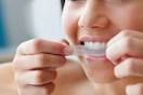 how to whiten teeth