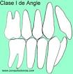 Denominamos <b>CLASE I</b> DE <b>ANGLE</b> a