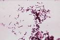 C. <b>tetani</b> Gram stain.