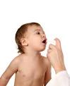 El asma en los niños (II)