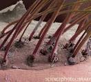 67 Not Out: The Hidden Alien World Of The Demodex Folliculorum