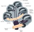 Cochlear Implants: Restoring Hearing to the Deaf