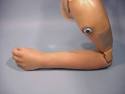 VASI Electric Elbows for Children | Liberating Technologies, Inc.