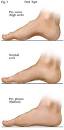 Finding Your Running Shoe: Matching foot type to shoe type