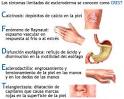 <b>limitada</b> de <b>Esclerodermia</b>