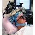 <b>Estimulación Magnética Transcraneal</b> | Alzheimer