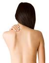 psoriasis