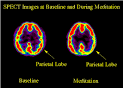 أسرار الشفاء بالصلاة ملف شامل  Images?q=tbn:ANd9GcTlKjw5VUn7XTLwJjQjOejmpEbZ1HyZXqhTVZ9GZ23eUwemwrM46TARwQ