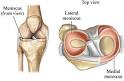 ACL - What Is The Anterior Cruciate Ligament? | ehealthMD