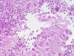 Herpes Dating H Date | The Herpes Blueprint