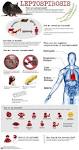 What is <b>leptospirosis</b>?