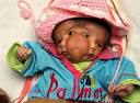 2face girl 2 Faced Baby Born in India picture. She was born with 4 eyes, ... - 2face-girl