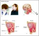 Surgery.com - Endoscopic Sinus Surgery Surgery Information ...