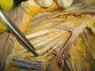 dissection: Definition, Synonyms from Answers.