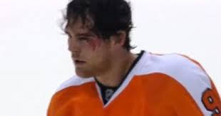 Earlier in the game, Flyers forward Steve Downie dropped the gloves with Capitals forward Aaron Volpatti. The end result was painful for Downie. - Steve-Downie-bloody-eye