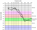 <b>high frequency hearing loss</b>