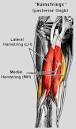 Hamstring Injuries