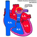 The <b>ductus arteriosus</b> is a