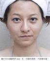 中風」的美容半邊臉實測