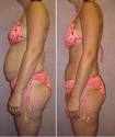 hcg diet info | hcg injections | hcg diet program | hcg weight loss