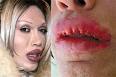 pete burns sex tape