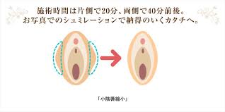 女性性器整形|婦人科形成 | 美容整形はTCB東京中央美容外科