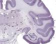 Hippocampus - Wikipedia, the free encyclopedia